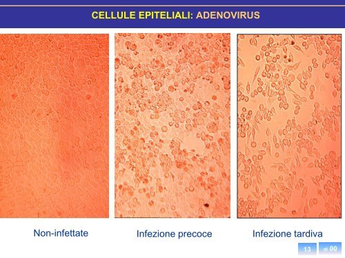 Diagnosi diretta - Sezione di Microbiologia