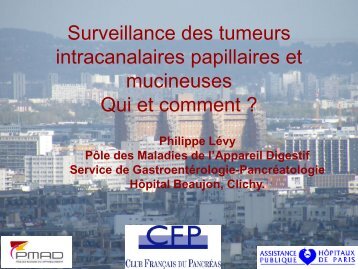 Surveillance des TIPMP : qui et comment ?