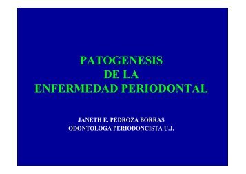 PATOGENIA DE LA ENFERMEDAD PERIODONTAL