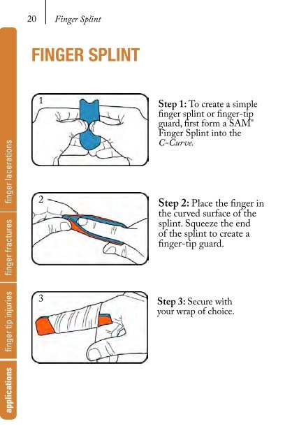 Sam Splint Manual.indd - Meetup