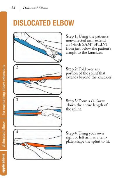 Sam Splint Manual.indd - Meetup