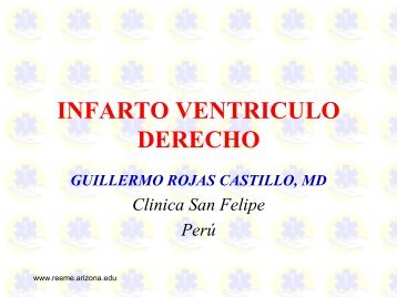 INFARTO VENTRICULO DERECHO - Reeme.arizona.edu