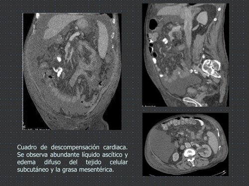 ANOMALÍAS DE ROTACIÓN