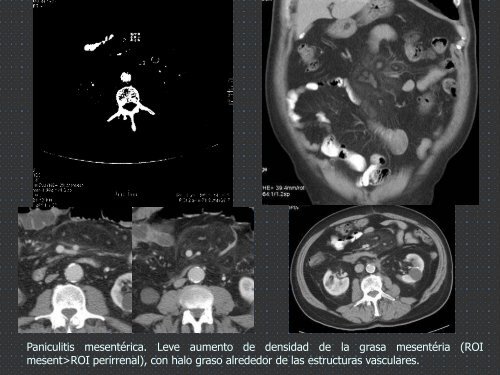 ANOMALÍAS DE ROTACIÓN