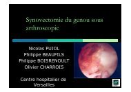 synovectomie du genou sous arthroscopie NP - ClubOrtho.fr