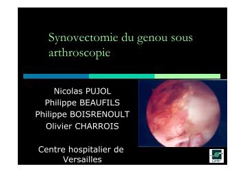 synovectomie du genou sous arthroscopie NP - ClubOrtho.fr