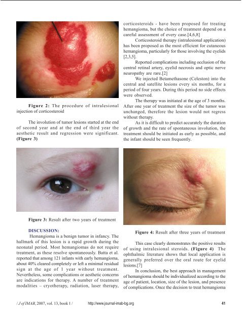 conservative treatment of cavernous hemangioma ... - Journal of IMAB