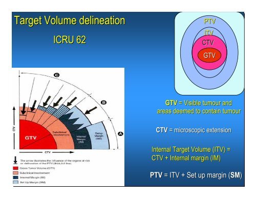 Target Volume delineation - AROI