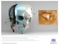 Brochure 3D Accuitomo Clinical Case Evidence - Morita