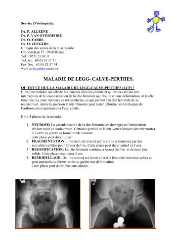 MALADIE DE LEGG- CALVE-PERTHES. - Dienst Orthopedie Ronse