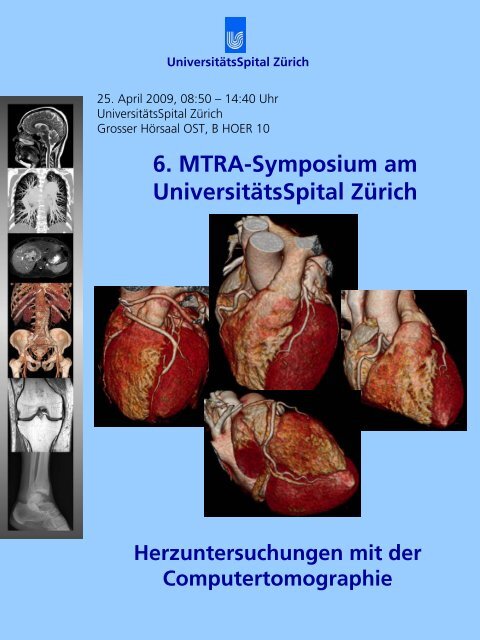 6. MTRA-Symposium am UniversitÃ¤tsSpital ZÃ¼rich - Radiologie ...