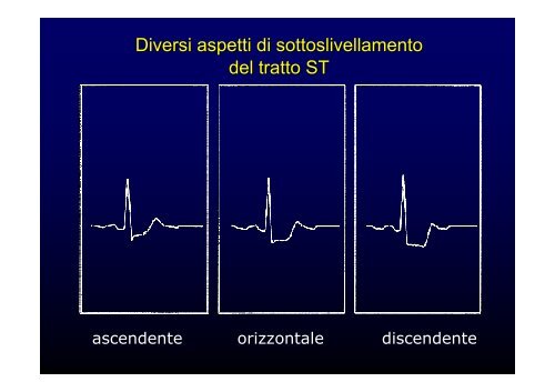 La cardiopatia ischemica - Cuorediverona.it
