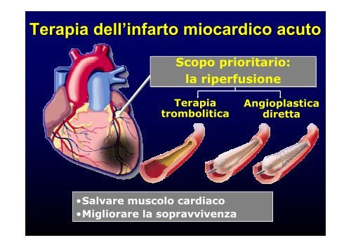 La cardiopatia ischemica - Cuorediverona.it