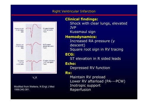 La cardiopatia ischemica - Cuorediverona.it