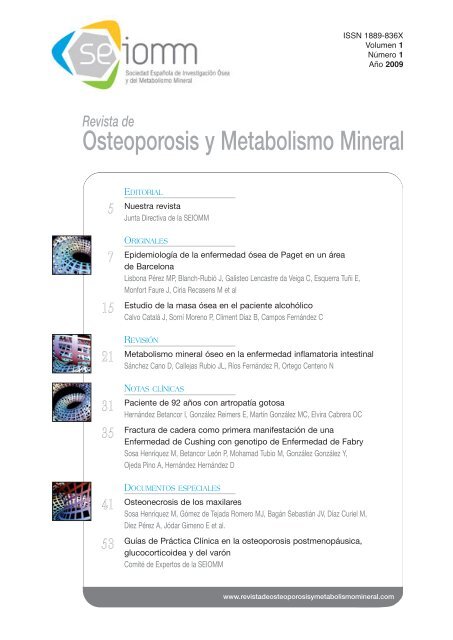 Nº 1 Español - Revista de Osteoporosis y Metabolismo Mineral