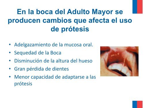 SALUD BUCAL EN EL ADULTO MAYOR