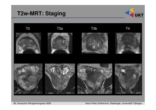 Die MRâTomographie und