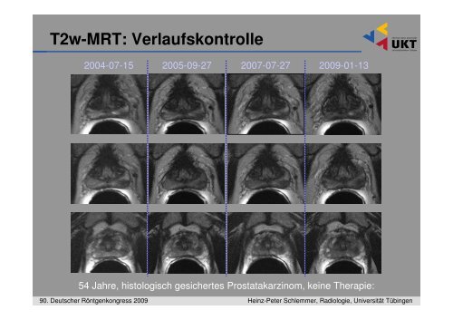 Die MRâTomographie und