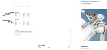 Clavicle Hook Plate. One implant for two indications. - Osteosyntese