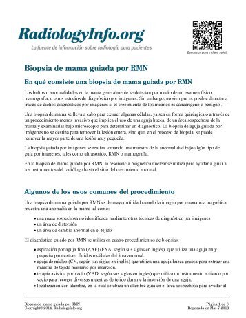 Biopsia de mama guiada por RMN - RadiologyInfo