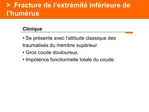 Fracture des mÃ©tacarpiens