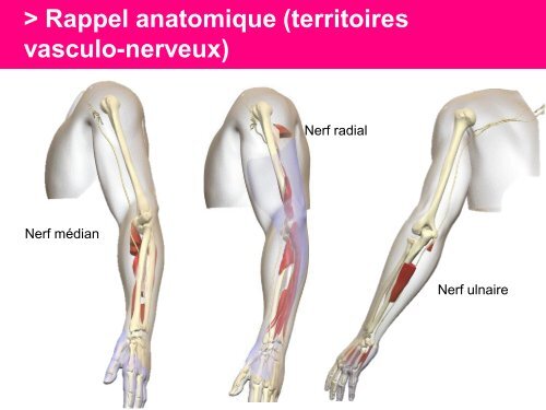 Fracture des mÃ©tacarpiens