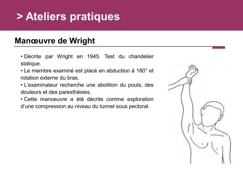 Fracture des mÃ©tacarpiens