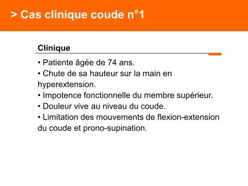 Fracture des mÃ©tacarpiens