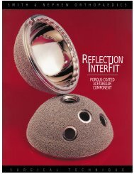 REFLECTIONÂ® INTERFITâ¢ - Bonerepmedical.com