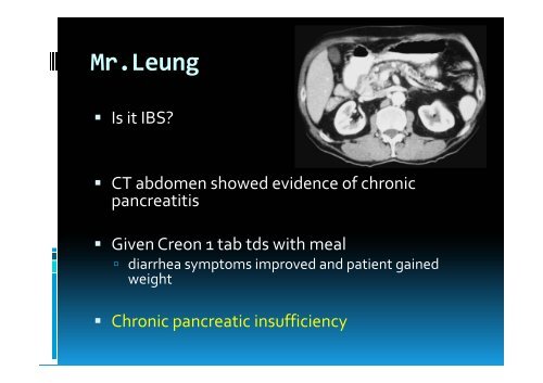 UPDATES ON MANAGEMENT OF IRRITABLE BOWEL SYNDROME