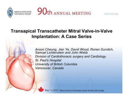 Transapical Transcatheter Mitral Valve-in-Valve Implantation: A ...