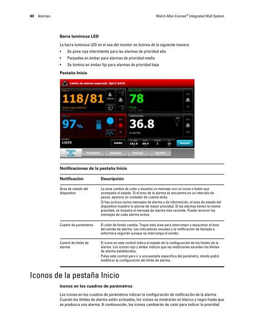 Instrucciones de uso, Welch Allyn ConnexÃ‚Â® Integrated Wall System