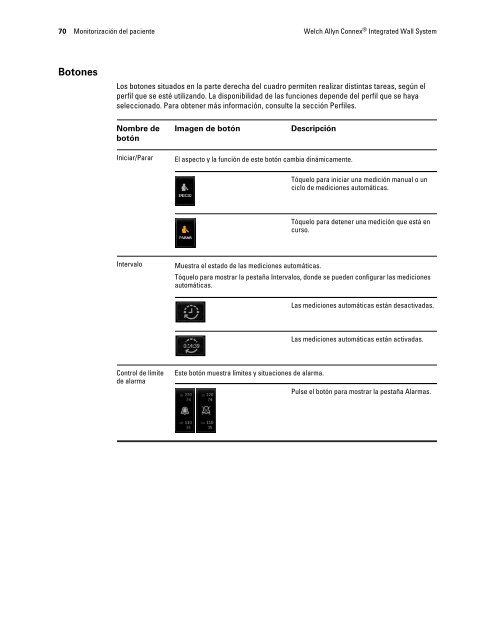 Instrucciones de uso, Welch Allyn ConnexÃ‚Â® Integrated Wall System