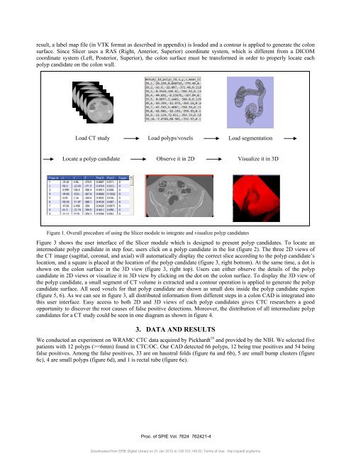 An open source implementation of colon CAD in 3D Slicer