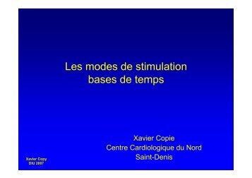 Les modes de stimulation bases de temps