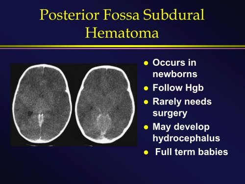 Head injury in children: From Lumps and Bumps to Bolts