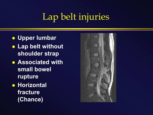 Head injury in children: From Lumps and Bumps to Bolts