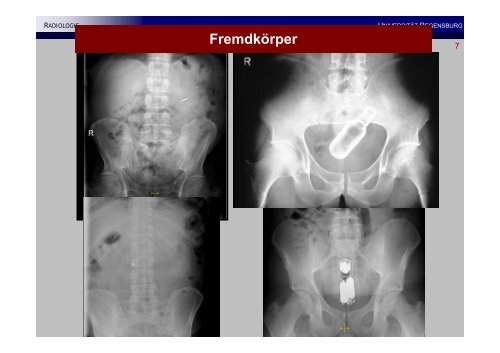 Basiswissen Akutes Abdomen, NotfÃ¤lle