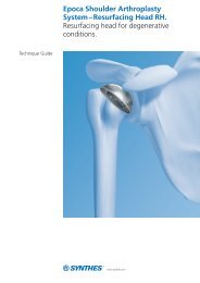 Epoca Shoulder Arthroplasty System â Resurfacing Head RH ...