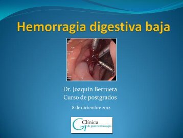 HEMORRAGIA DIGESTIVA MEDIA