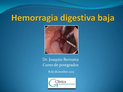 HEMORRAGIA DIGESTIVA MEDIA