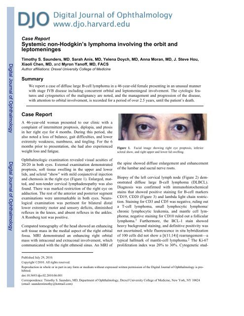 Download PDF - Digital Journal of Ophthalmology