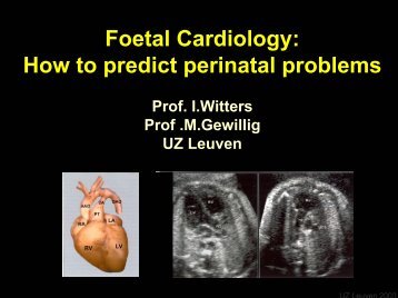 Foetal Cardiology: How to predict perinatal problems - UZ Leuven