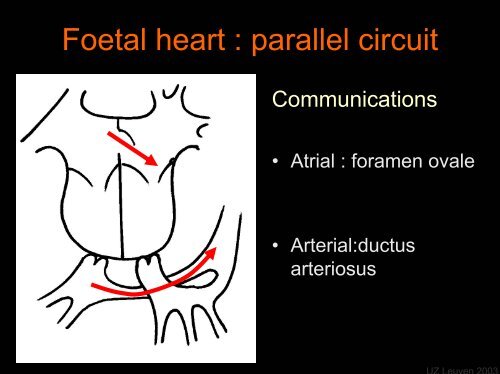 Foetal Cardiology: How to predict perinatal problems - UZ Leuven