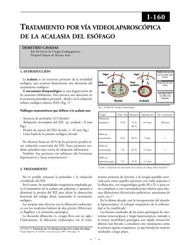 Tratamiento por vÃ­a videolaparoscÃ³pica de la acalasia ... - sacd.org.ar