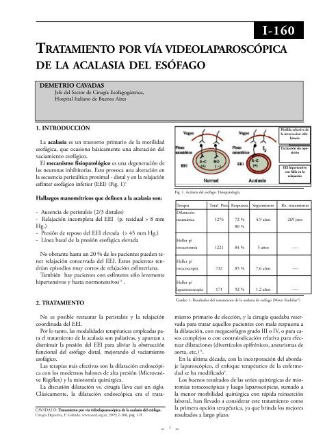 Tratamiento por vÃ­a videolaparoscÃ³pica de la acalasia ... - sacd.org.ar