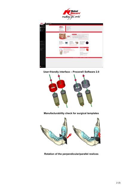 ProceraÂ® Software Clinical Design 2.0 â - Nobel Biocare