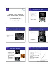 Landmarks in early pregnancy, growth and diagnosing miscarriage ...