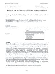 Autogenous tooth transplantation: Evaluation of pulp tissue ... - RIHUC