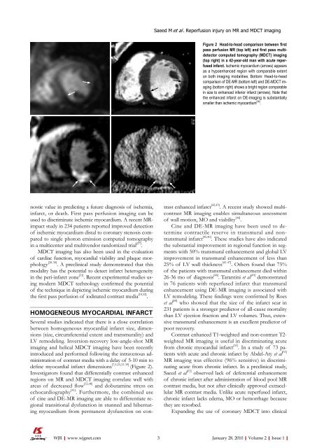 World Journal of Radiology - World Journal of Gastroenterology